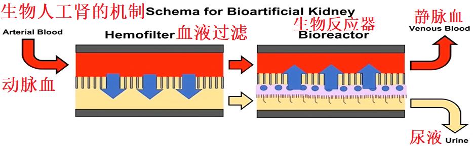 人工肾脏最新研究成果，突破与创新的前沿探索